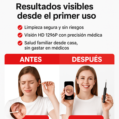 Limpiador de Oídos Pro – con Cámara HD y Luz LED