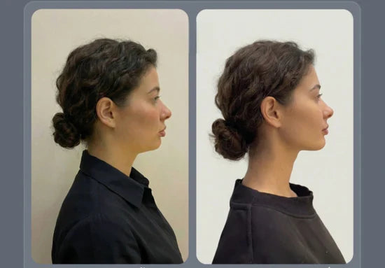 Faja Facial Reafirmante: Define y Moldea tu Rostro en 21 Días + Guía Exclusiva GRATIS