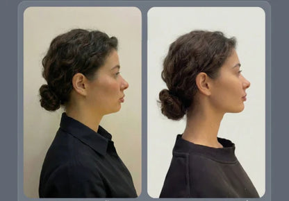 Faja Facial Reafirmante: Define y Moldea tu Rostro en 21 Días + Guía Exclusiva GRATIS