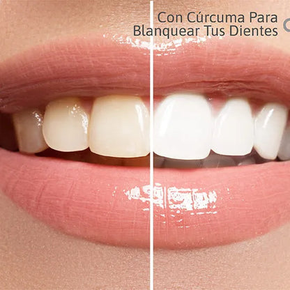 CARBON WHITE: Blanqueador Dental Avanzado